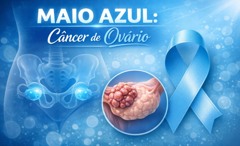 Maio Azul: Câncer de ovário avança de forma silenciosa e exige diagnóstico precoce