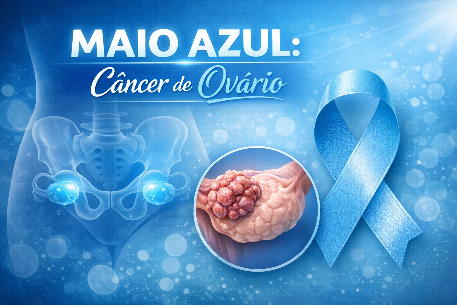 Maio Azul: Câncer de ovário avança de forma silenciosa e exige diagnóstico precoce