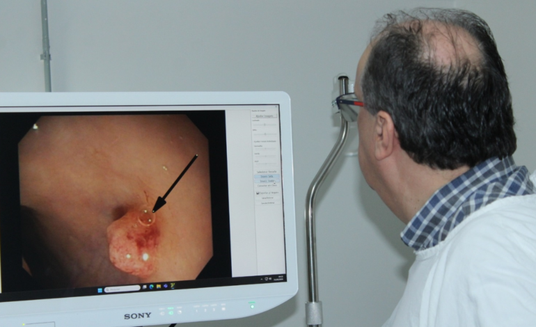 Centro de Endoscopia ‘Akira Nakadaira’ da Santa Casa de Marília realiza cerca de 4,8 mil procedimentos por ano e mantém tradição pioneira no Brasil
