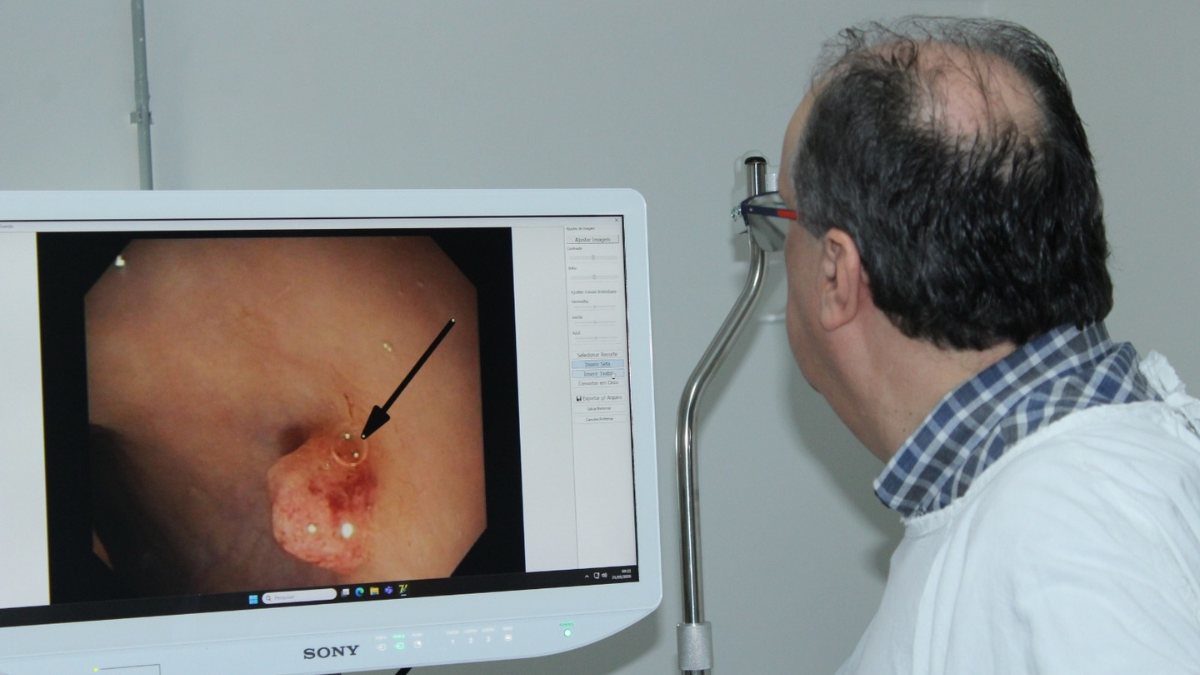 Centro de Endoscopia ‘Akira Nakadaira’ da Santa Casa de Marília realiza cerca de 4,8 mil procedimentos por ano e mantém tradição pioneira no Brasil