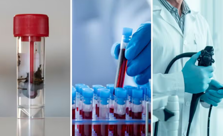 Exames de sangue e fezes são incluídos como novas opções para rastreamento de câncer colorretal