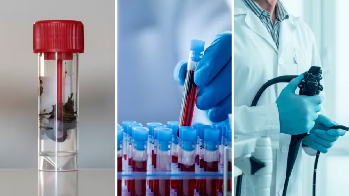 Exames de sangue e fezes são incluídos como novas opções para rastreamento de câncer colorretal