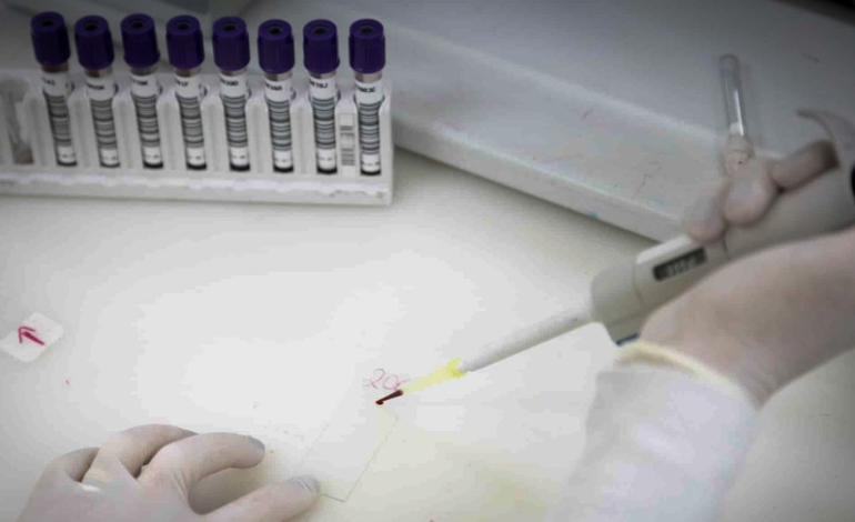 Secretaria de Saúde de SP investiga novo caso suspeito de ebola