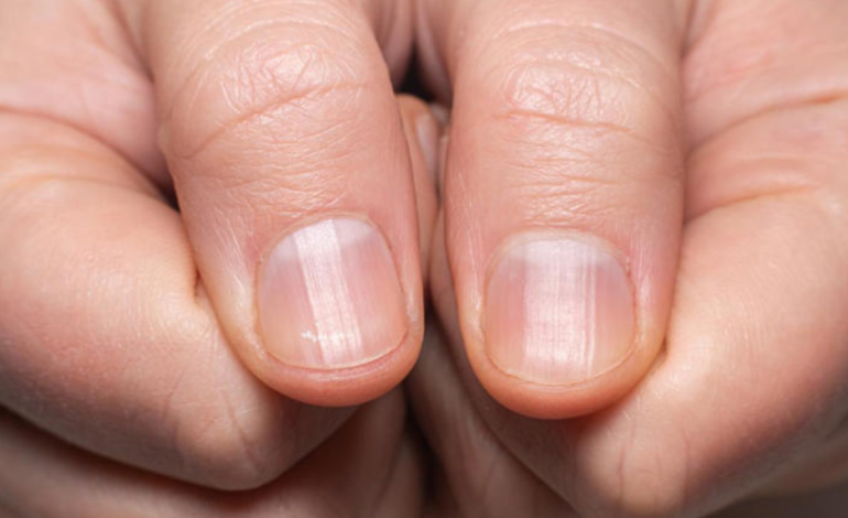 Sua pele e unhas podem revelar falta de vitaminas; veja 3 sinais de alerta