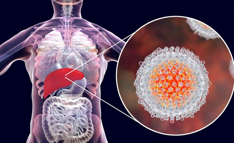 Julho Amarelo: Brasil registrou mais de 826 mil casos de hepatites virais; infectologista esclarece mitos e verdades sobre as doenças