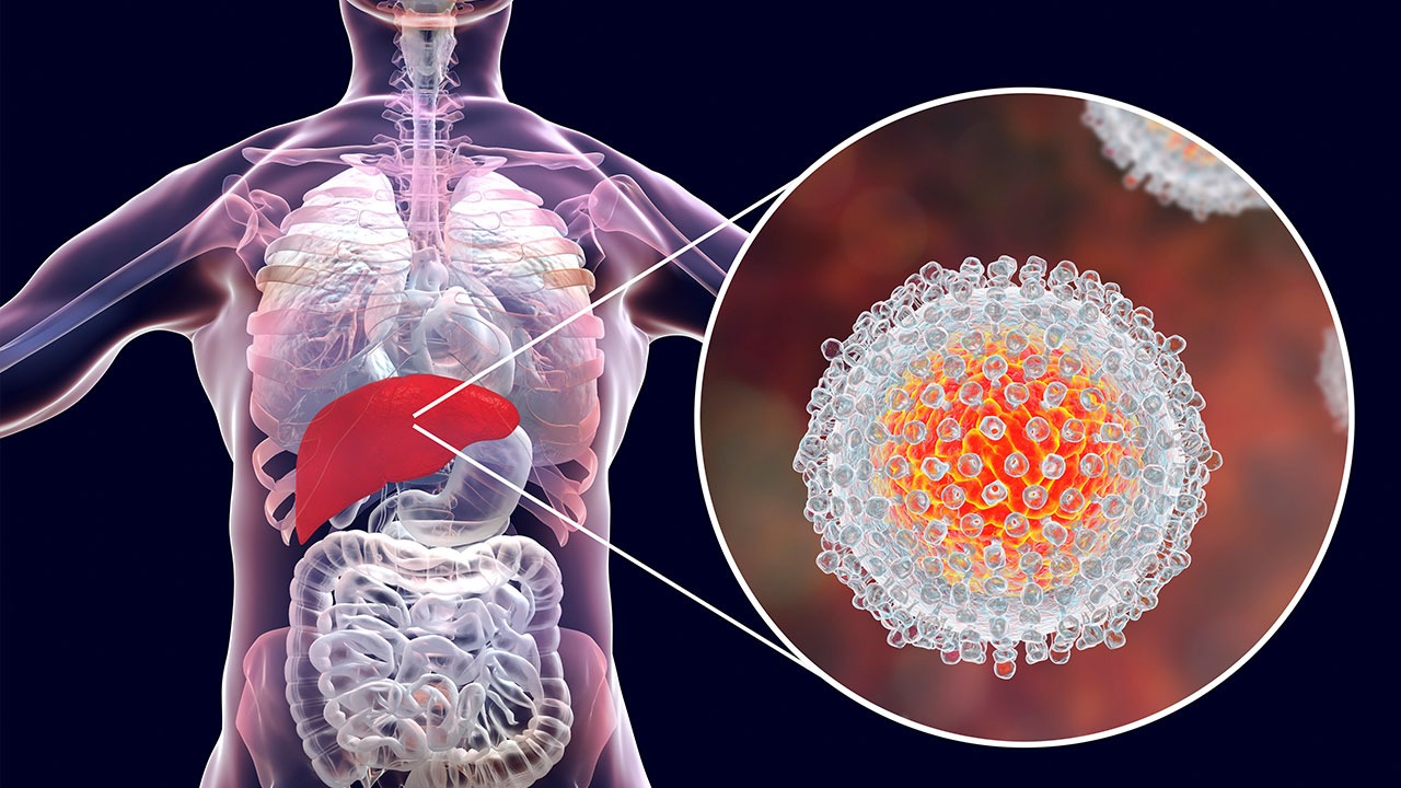 Julho Amarelo: Brasil registrou mais de 826 mil casos de hepatites virais; infectologista esclarece mitos e verdades sobre as doenças