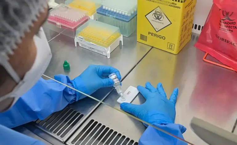 Anvisa atualiza regras sobre controle de qualidade em laboratórios