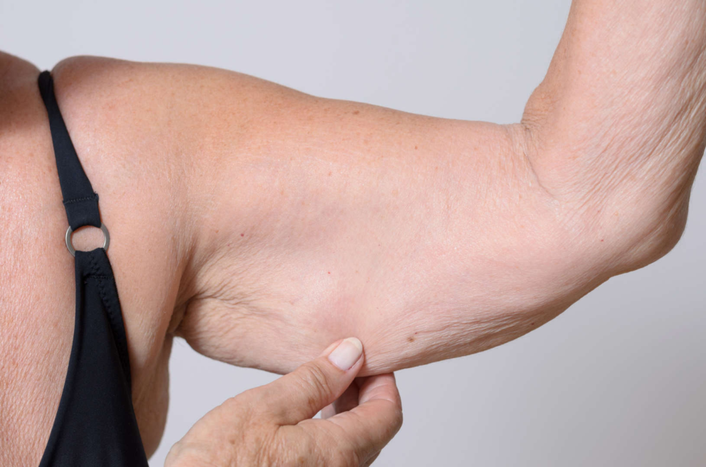 O que o emagrecimento muito rápido pode causar no corpo | revistasaudeemforma.com.br image 3 1024x678