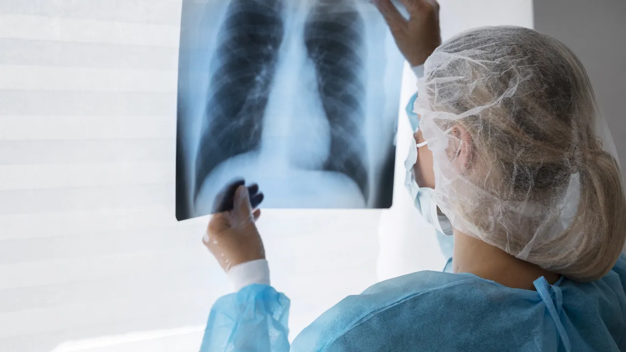 Diagnóstico tardio deixa quase metade dos pacientes com câncer de pulmão sem tratamento