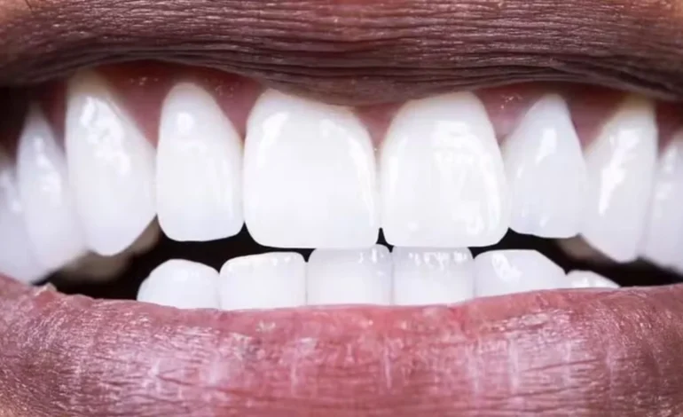 Como proteger as boas bactérias da sua boca e manter a saúde oral