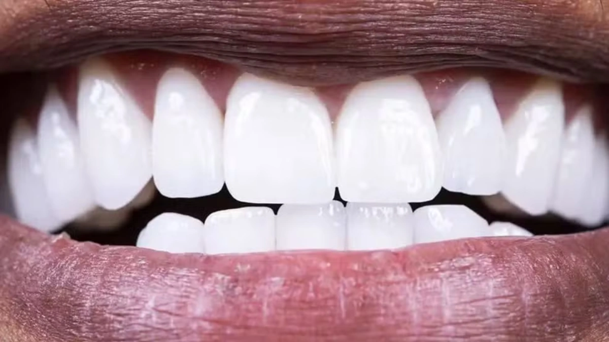 Como proteger as boas bactérias da sua boca e manter a saúde oral