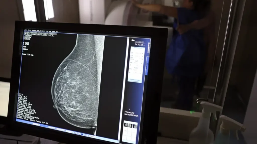 Planos de saúde serão obrigados a cobrir mamografia digital para todas as idades a partir de outubro | revistasaudeemforma.com.br SITES 4 3 1024x576