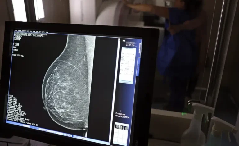 Planos de saúde serão obrigados a cobrir mamografia digital para todas as idades a partir de outubro