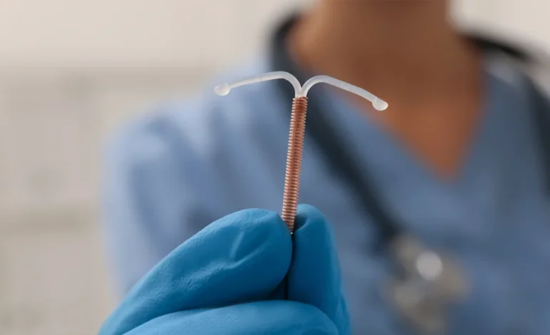 ANS determina cobertura obrigatória de DIU hormonal para endometriose em planos de saúde