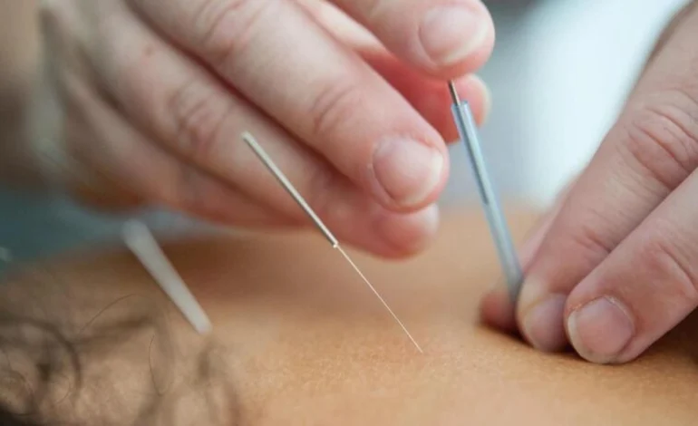 Acupuntura auxilia no tratamento da depressão, mas não substitui psiquiatria e terapia, alerta especialista