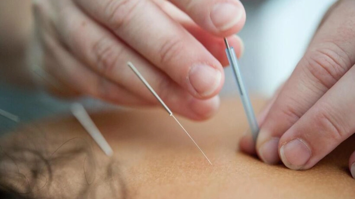 Acupuntura auxilia no tratamento da depressão, mas não substitui psiquiatria e terapia, alerta especialista