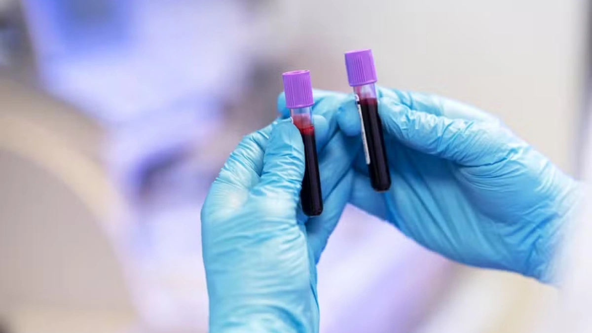 Novartis suspende testes de terapia experimental para doenças autoimunes e neurológicas após três mortes